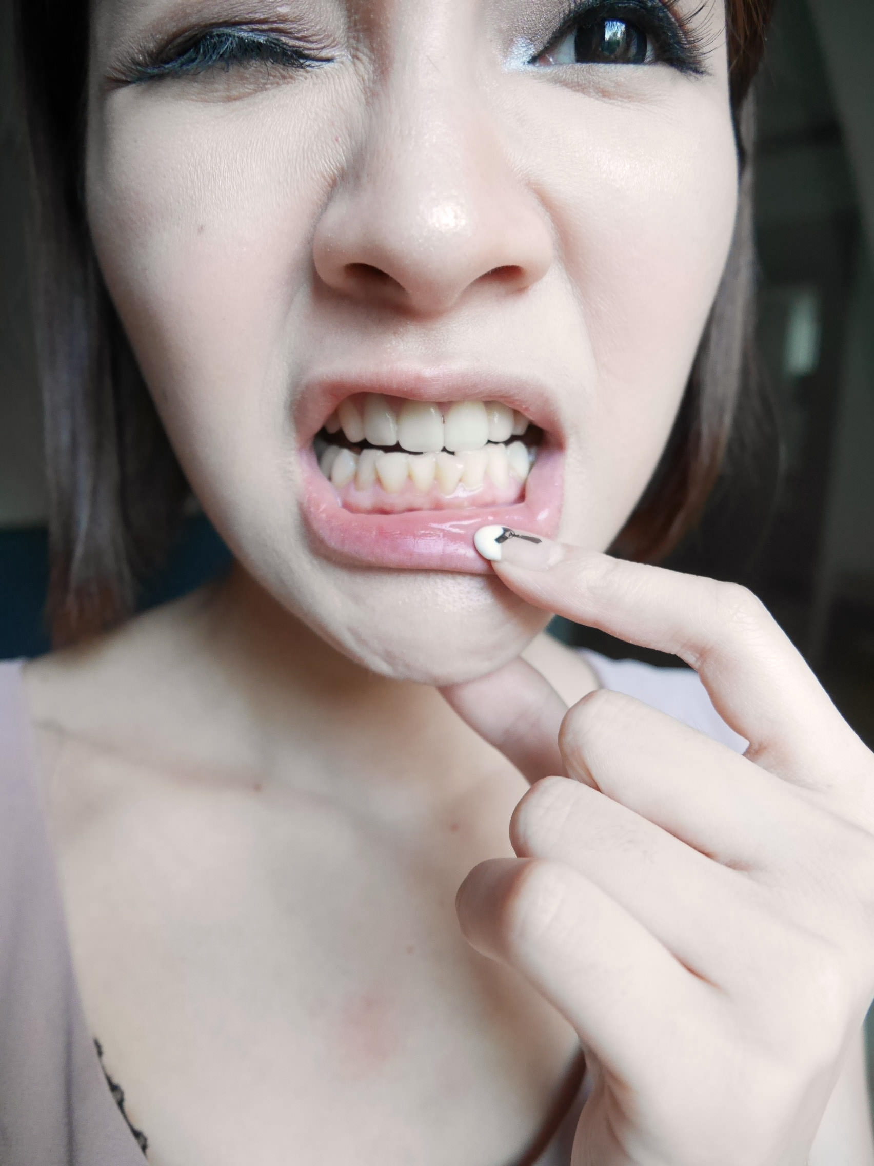 [美齒] 不需大鋼牙,也可以讓牙齒偷偷變漂亮-Invisalign隱適美牙套