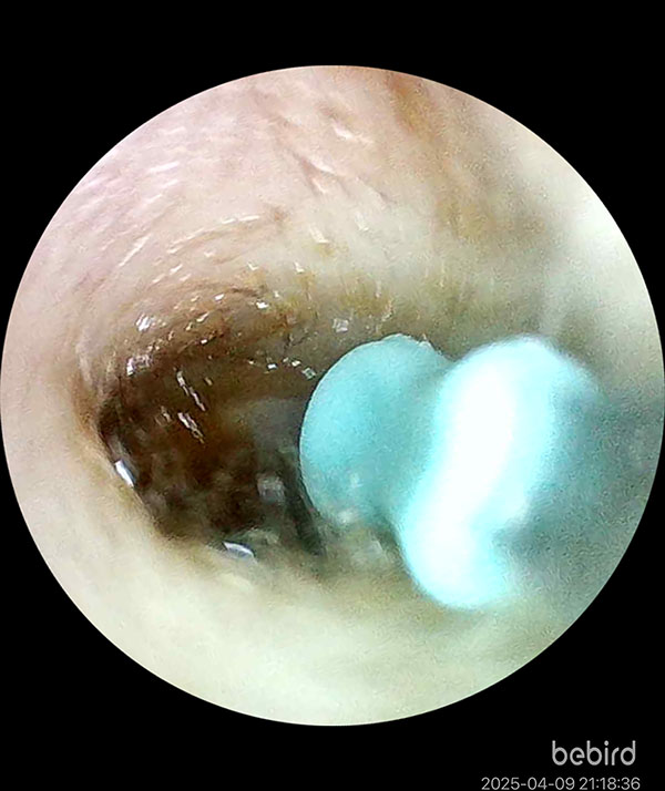 [啾團] Bebird 蜂鳥-HOME 30S 智慧科技可彎折微型攝影掏耳棒,可看見耳內更舒適安全