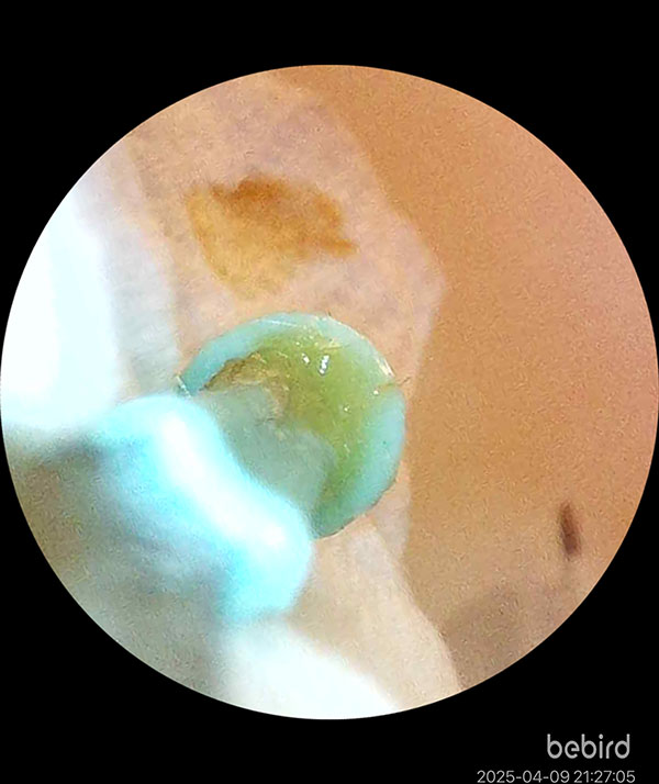 [啾團] Bebird 蜂鳥-HOME 30S 智慧科技可彎折微型攝影掏耳棒,可看見耳內更舒適安全