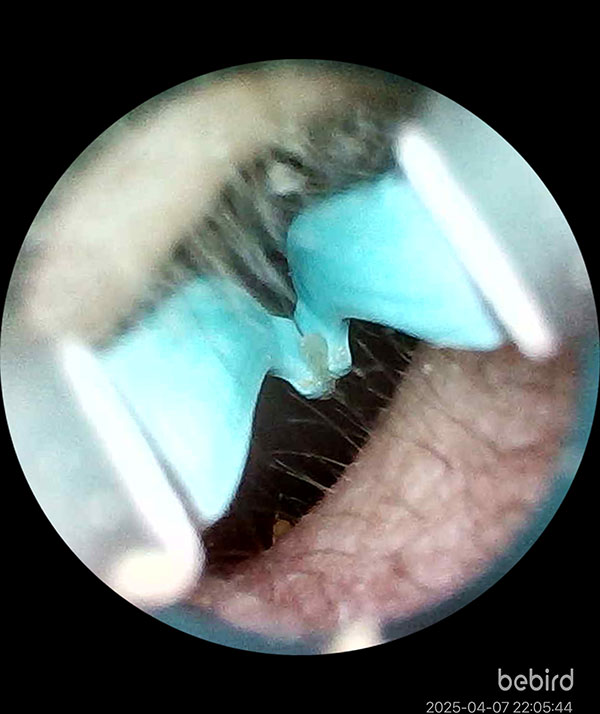 [啾團] Bebird 蜂鳥-HOME 30S 智慧科技可彎折微型攝影掏耳棒,可看見耳內更舒適安全