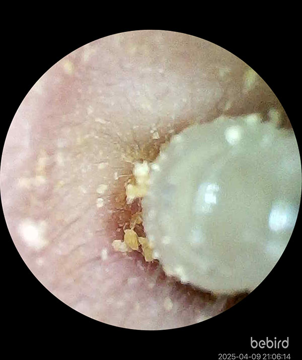 [啾團] Bebird 蜂鳥-HOME 30S 智慧科技可彎折微型攝影掏耳棒,可看見耳內更舒適安全