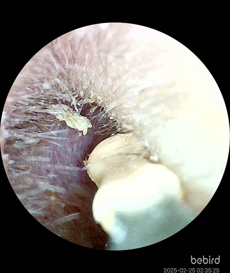 [啾團] Bebird 蜂鳥-HOME 30S 智慧科技可彎折微型攝影掏耳棒,可看見耳內更舒適安全