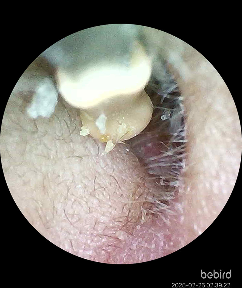 [啾團] Bebird 蜂鳥-HOME 30S 智慧科技可彎折微型攝影掏耳棒,可看見耳內更舒適安全