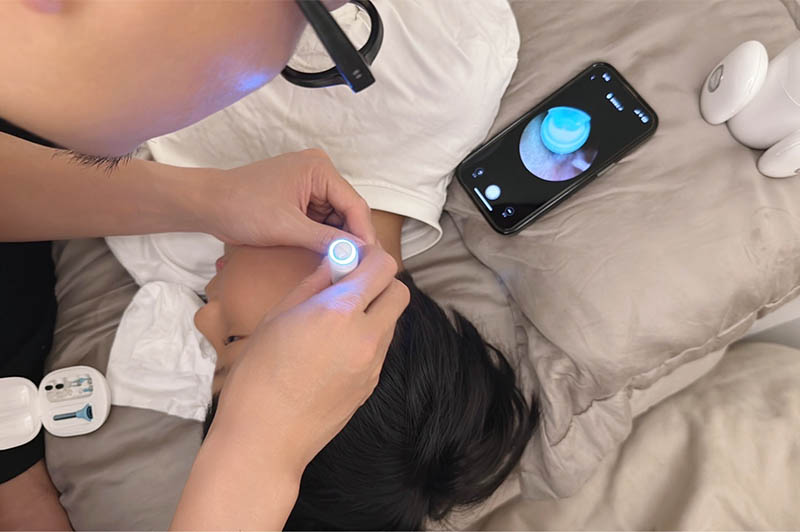 [啾團] Bebird 蜂鳥-HOME 30S 智慧科技可彎折微型攝影掏耳棒,可看見耳內更舒適安全