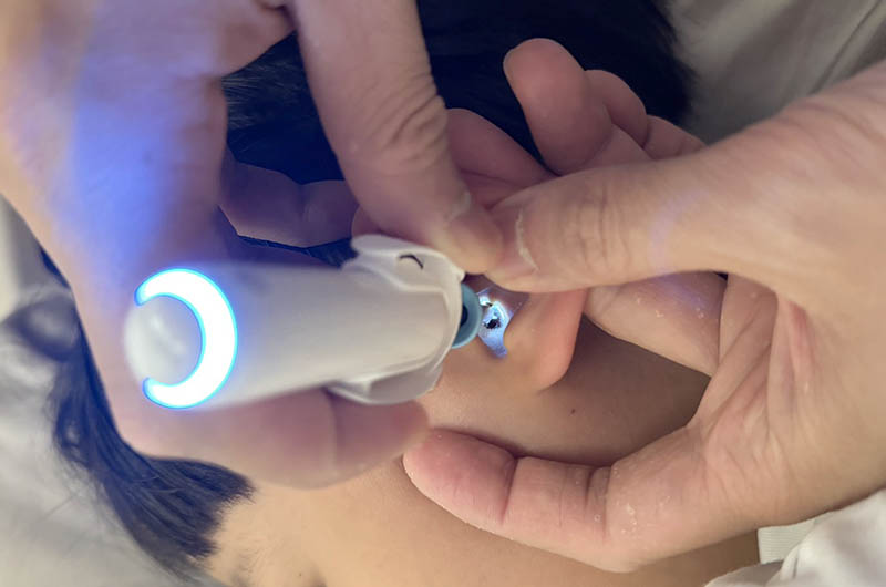 [啾團] Bebird 蜂鳥-HOME 30S 智慧科技可彎折微型攝影掏耳棒,可看見耳內更舒適安全