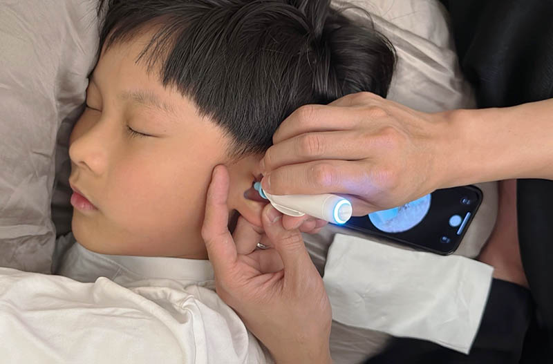 [啾團] Bebird 蜂鳥-HOME 30S 智慧科技可彎折微型攝影掏耳棒,可看見耳內更舒適安全