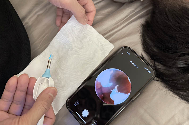 [啾團] Bebird 蜂鳥-HOME 30S 智慧科技可彎折微型攝影掏耳棒,可看見耳內更舒適安全