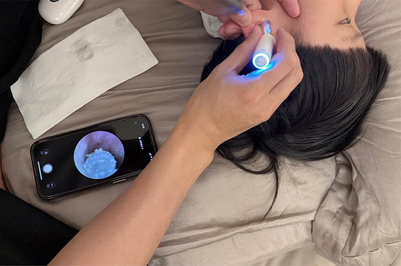 [啾團] Bebird 蜂鳥-HOME 30S 智慧科技可彎折微型攝影掏耳棒,可看見耳內更舒適安全