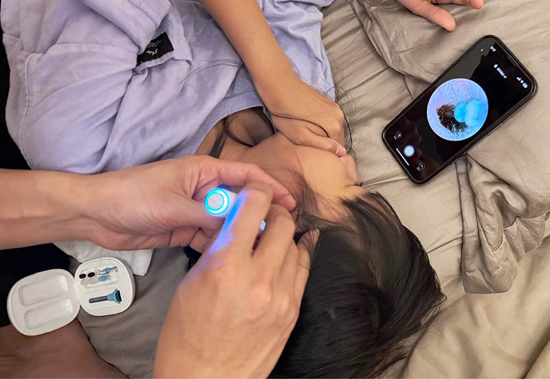 [啾團] Bebird 蜂鳥-HOME 30S 智慧科技可彎折微型攝影掏耳棒,可看見耳內更舒適安全