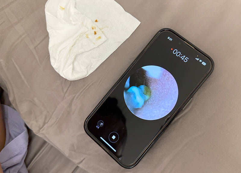 [啾團] Bebird 蜂鳥-HOME 30S 智慧科技可彎折微型攝影掏耳棒,可看見耳內更舒適安全