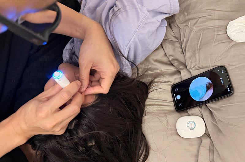 [啾團] Bebird 蜂鳥-HOME 30S 智慧科技可彎折微型攝影掏耳棒,可看見耳內更舒適安全