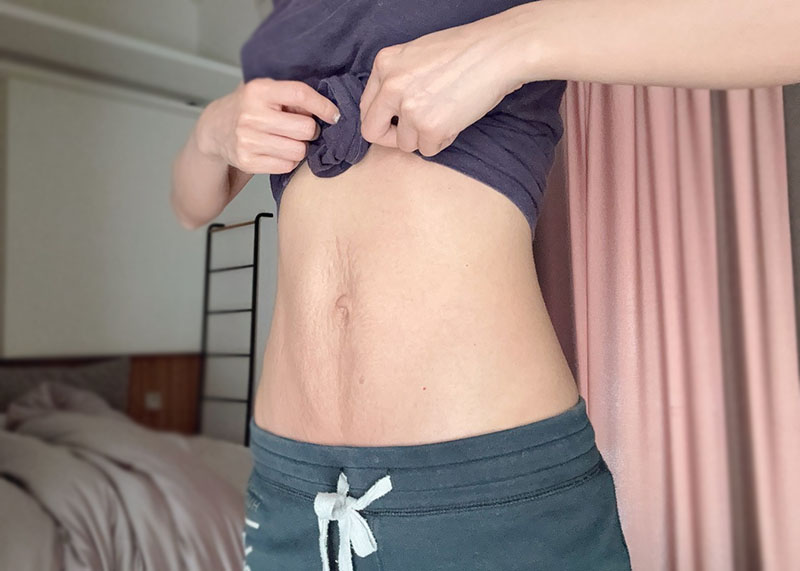 [啾團] NUEVA Volta™ S 超微電光能緊緻儀，幫你收緊肌膚，打造漂亮線條 #超纖棒