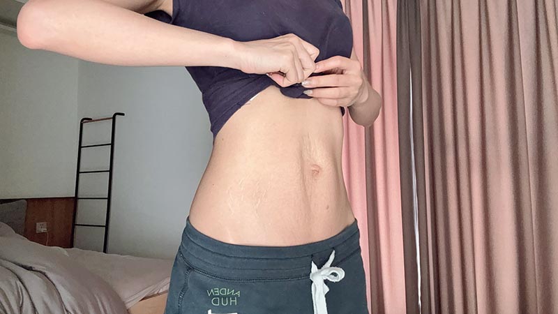 [啾團] NUEVA Volta™ S 超微電光能緊緻儀，幫你收緊肌膚，打造漂亮線條 #超纖棒