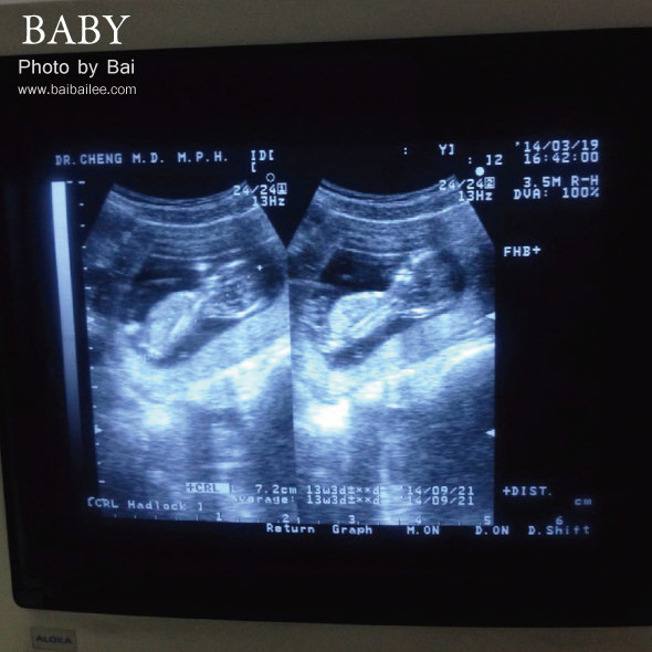 [R&B] 我的懷孕量基礎體溫小秘訣&孕媽咪好書推薦*BABY14週了